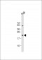 VHL Antibody (C-term)
